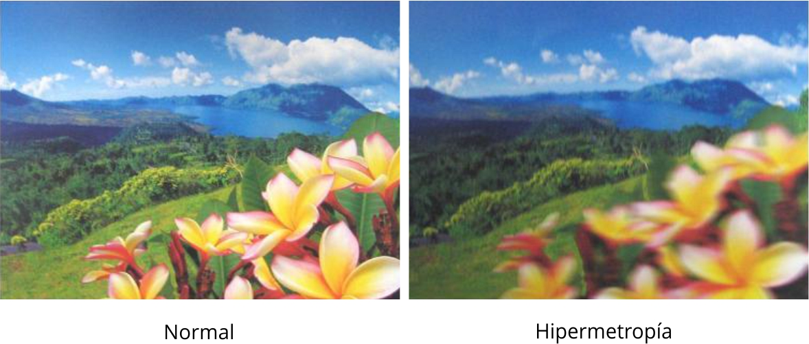 Hipermetropía espiritual