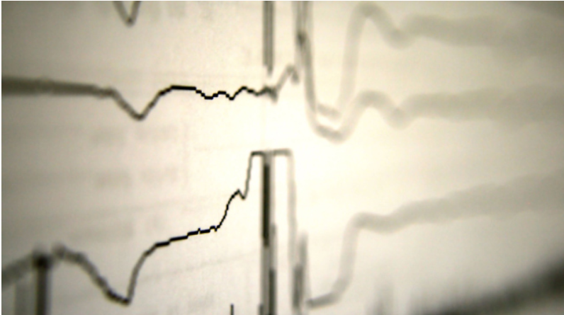 El momento de la verdad